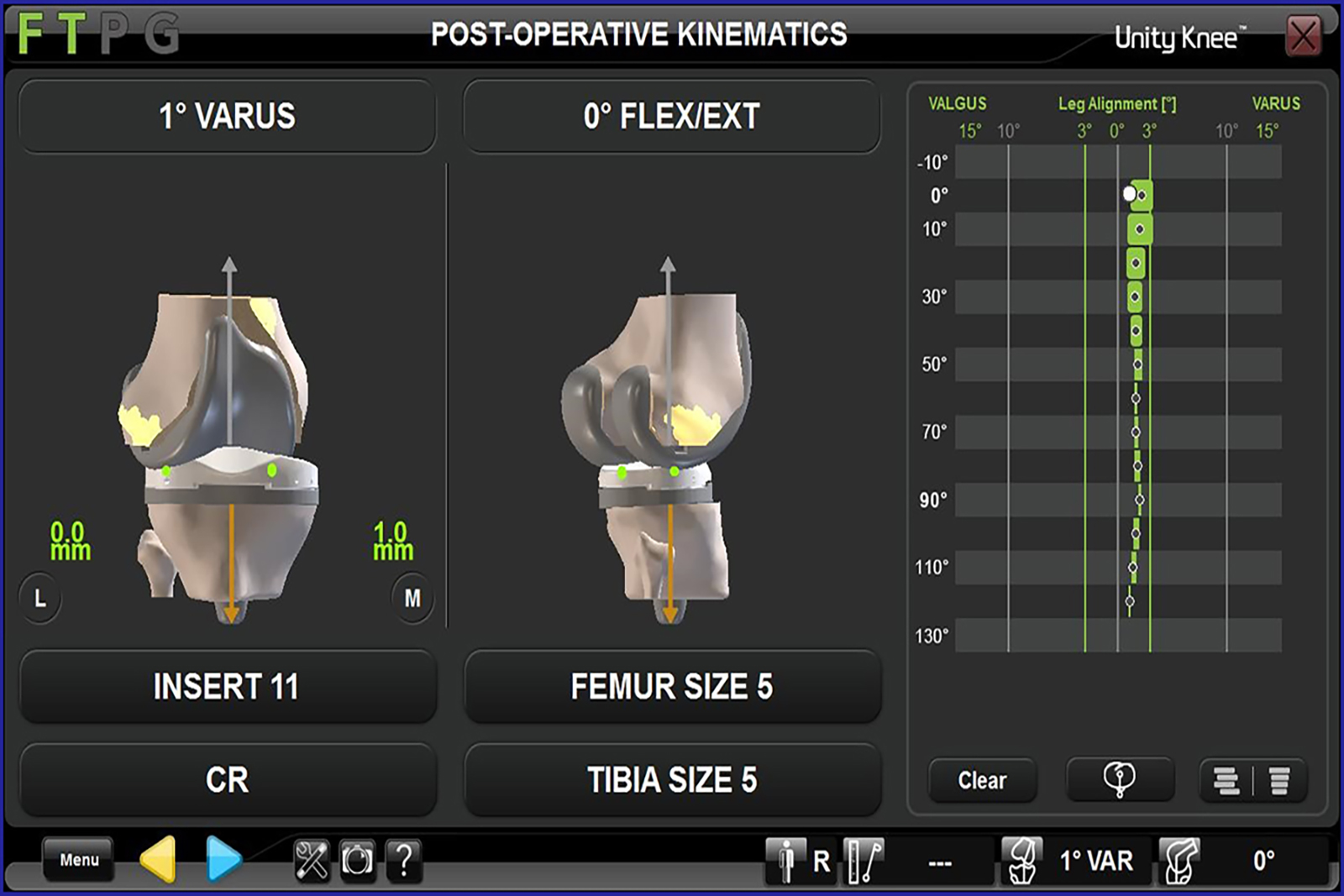 Unity Knee Post-Operative Kinematics